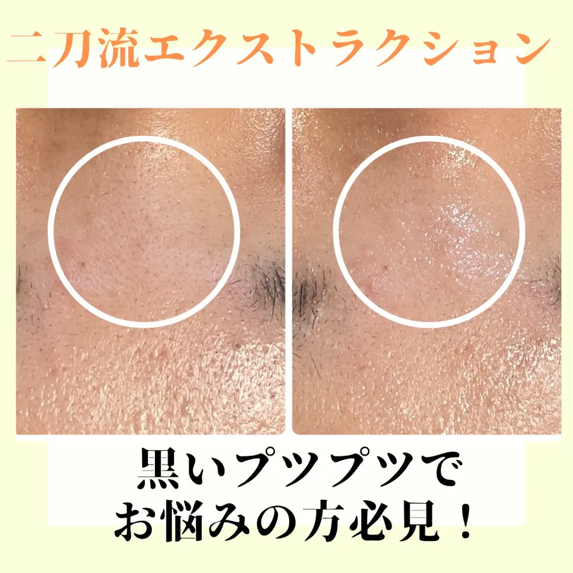 ピーリング専門店 Belluteのエステ・リラクイメージ