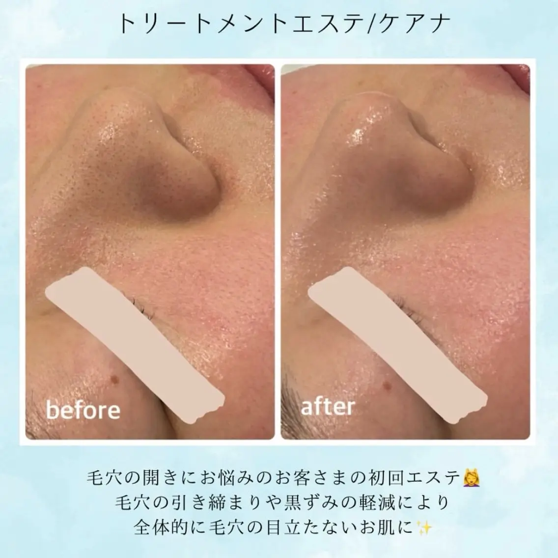 ナリス化粧品 Yumenaのエステ・リラクイメージ