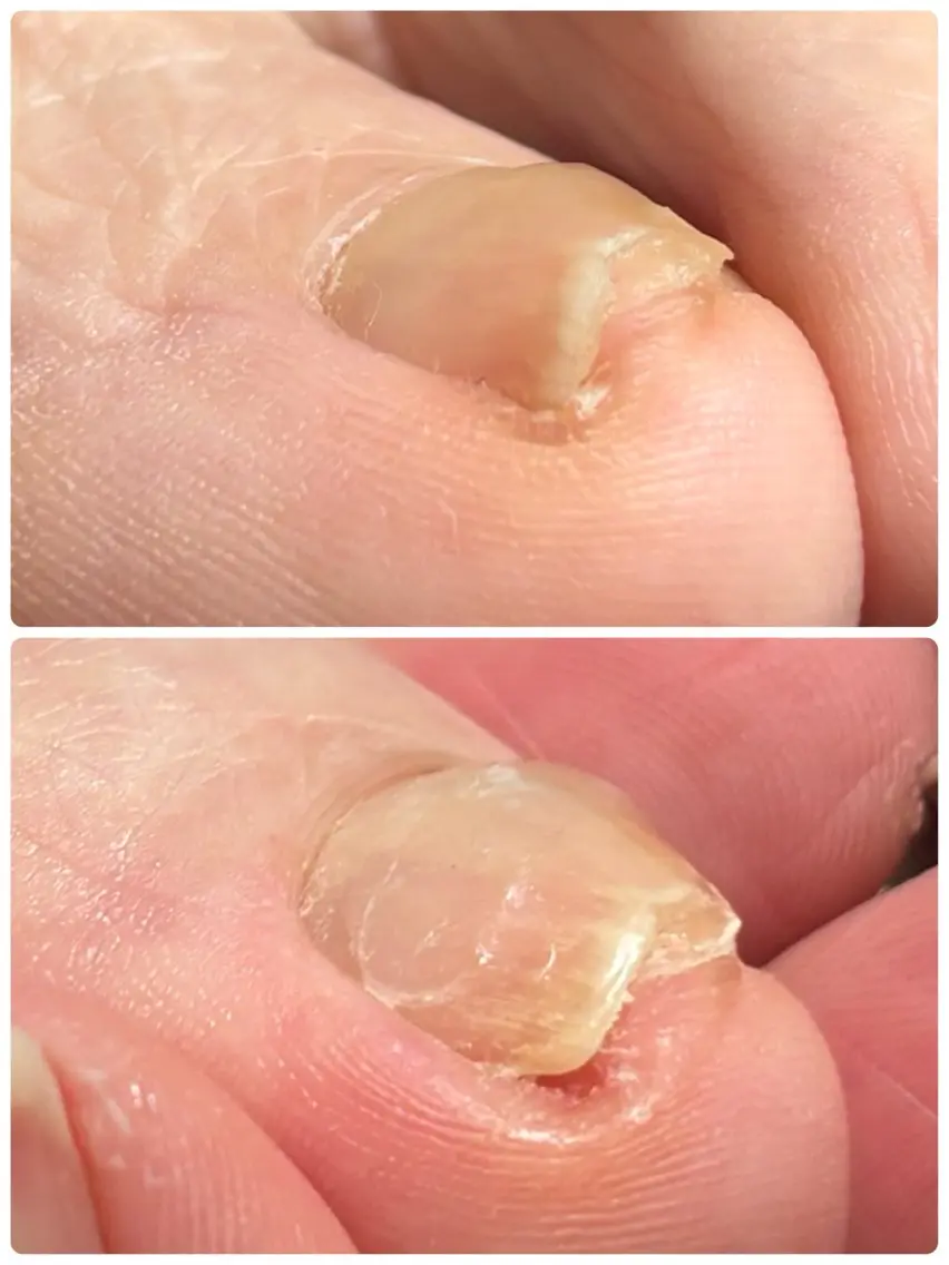 ネイル Alo.nail アロ•ネイルのネイルデザイン