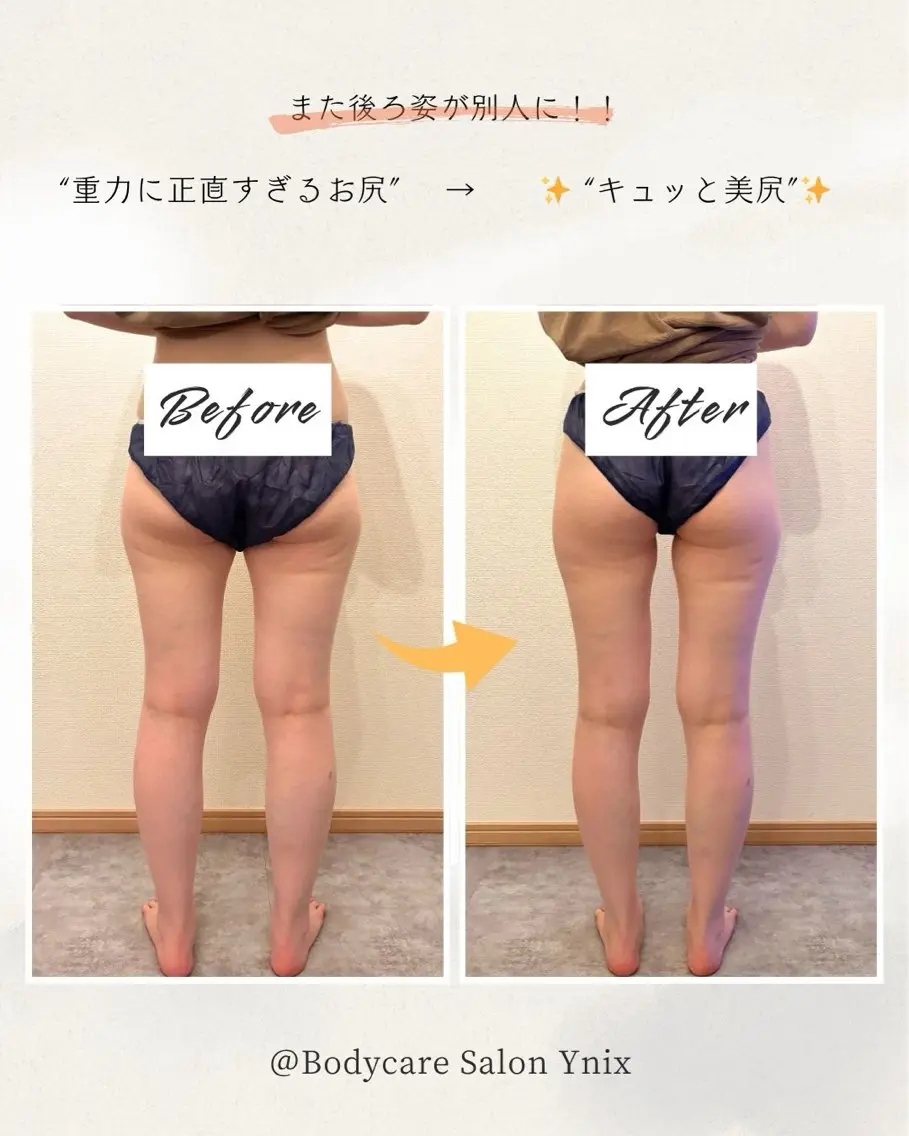 Bodycare salon Ynixのその他イメージ