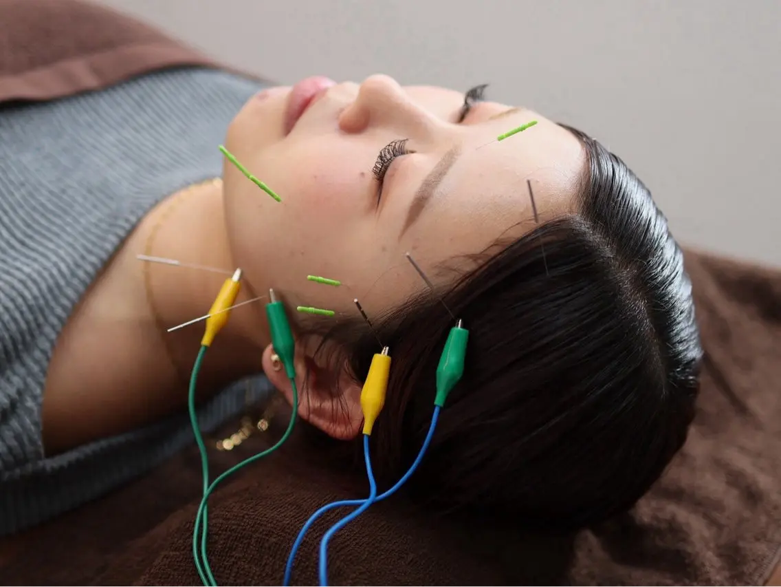 リラク 睡眠美容鍼・整体 Somniaそうすけのエステ・リラクイメージ