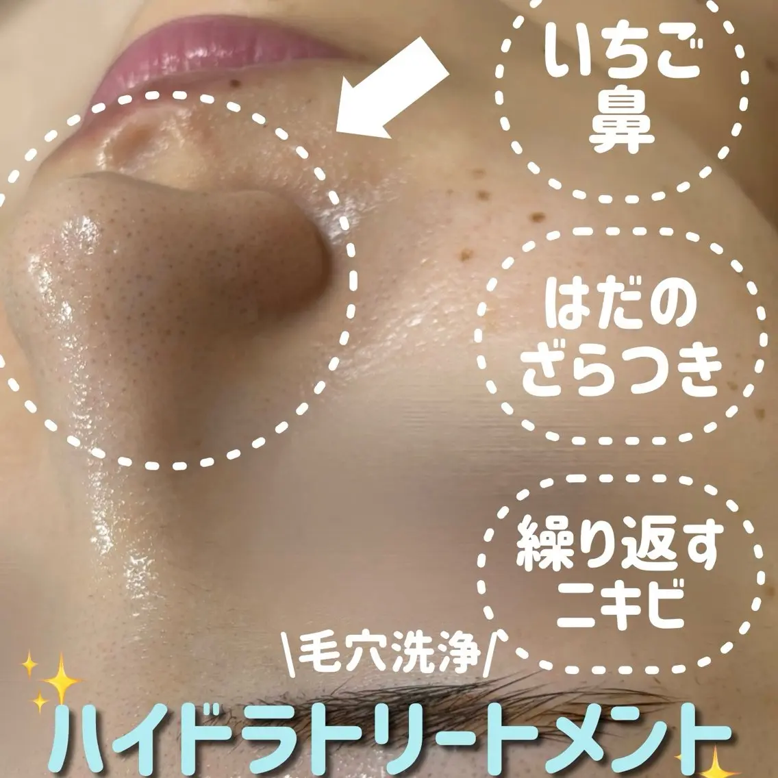 その他 lulularico Yuのネイルデザイン