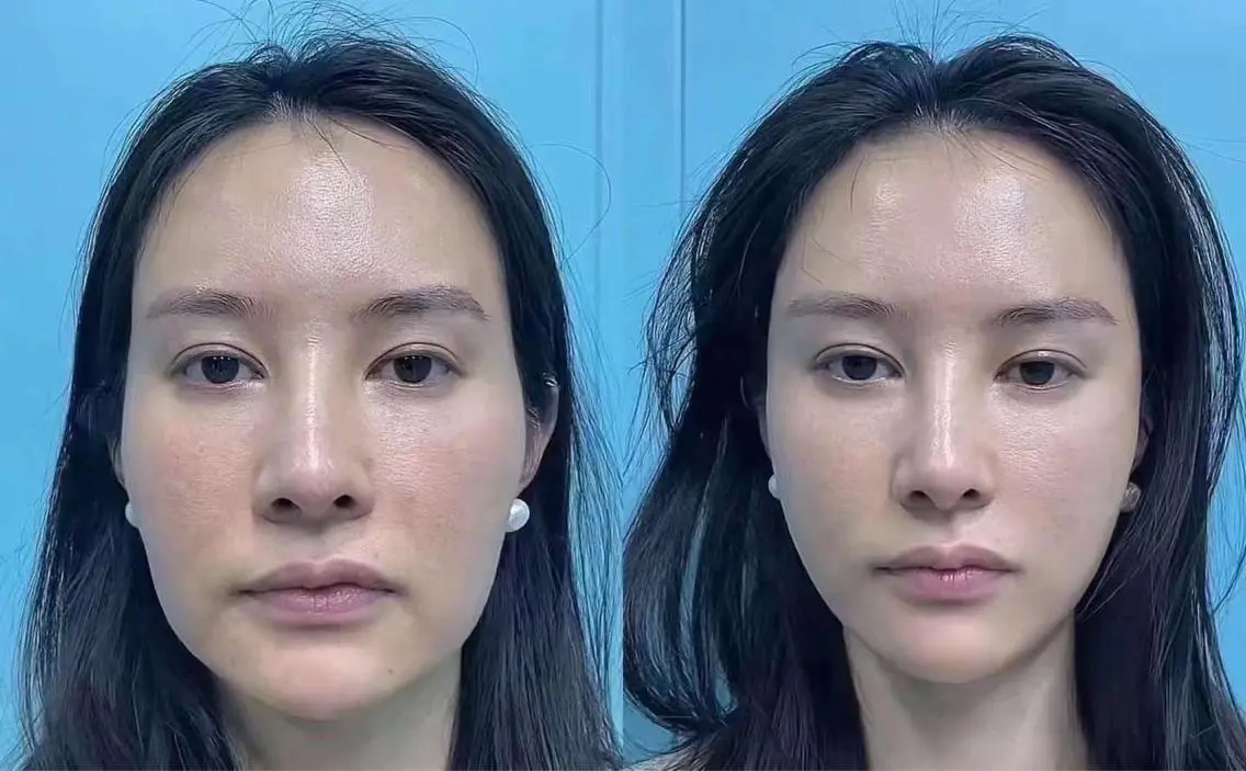 ネイル マツエク・マツパ 赤色 愛維美水光専門店 川崎彩鳳のエステ・リラクイメージ