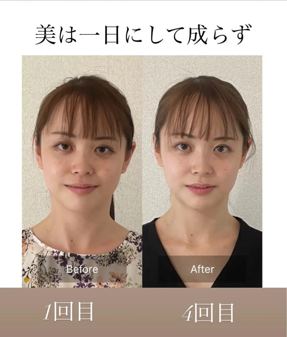 【1時間で生まれ変わる】全身の疲れを取りたい！コリが辛い！むくみを取りたい！5歳若返る、自分史上最強の小顔に🙆‍♀️の写真