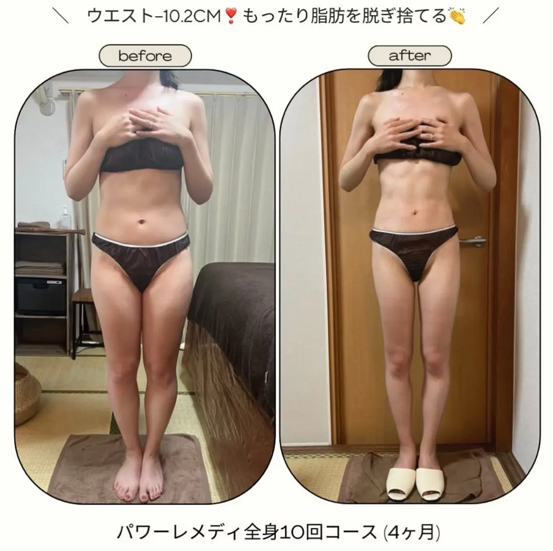 《本気痩せ×疲労改善 》  BILOOPのエステ・リラクイメージ