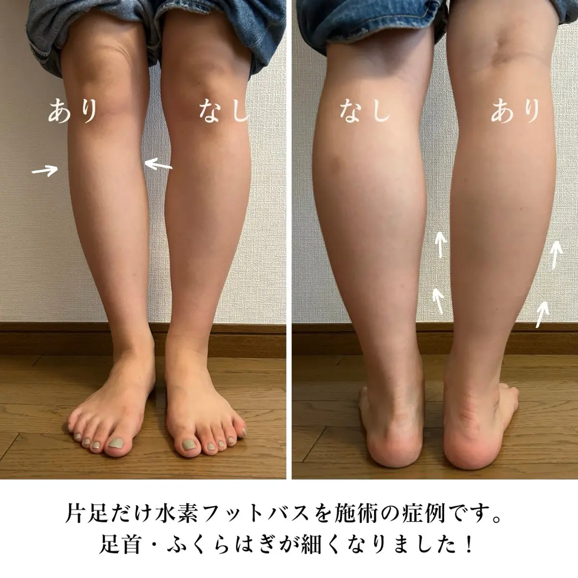 【目黒】本格痩身✴︎ 最新型よもぎ蒸しのエステ・リラクイメージ