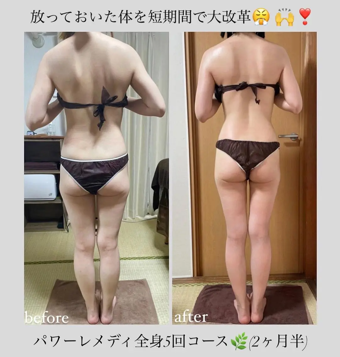 《本気痩せ×疲労改善 》 BILOOPのエステ・リラクイメージ