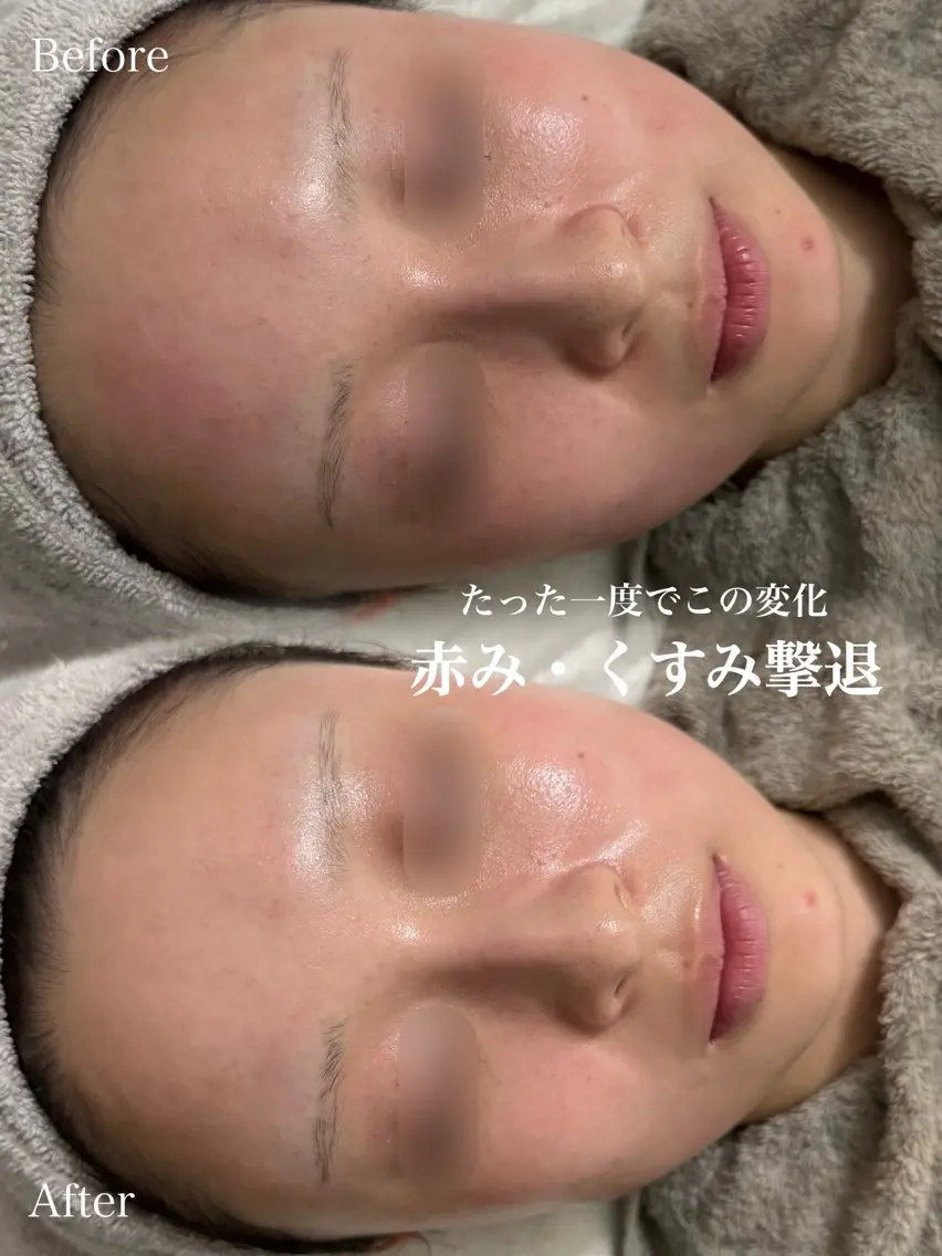 エステ SALON el KARINのその他イメージ