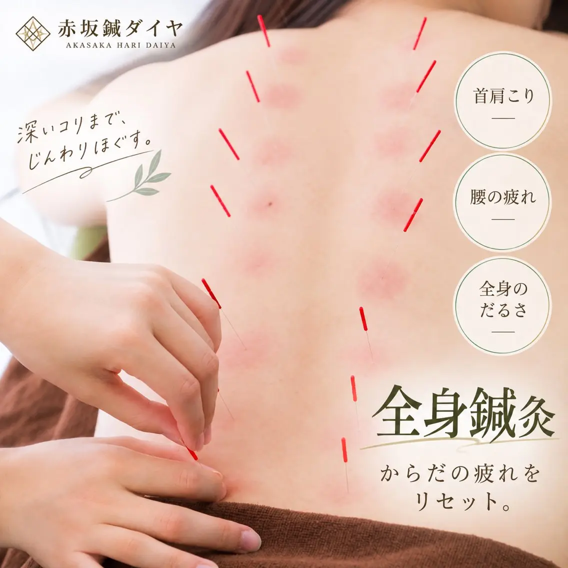 その他 赤坂 鍼ダイヤのその他イメージ