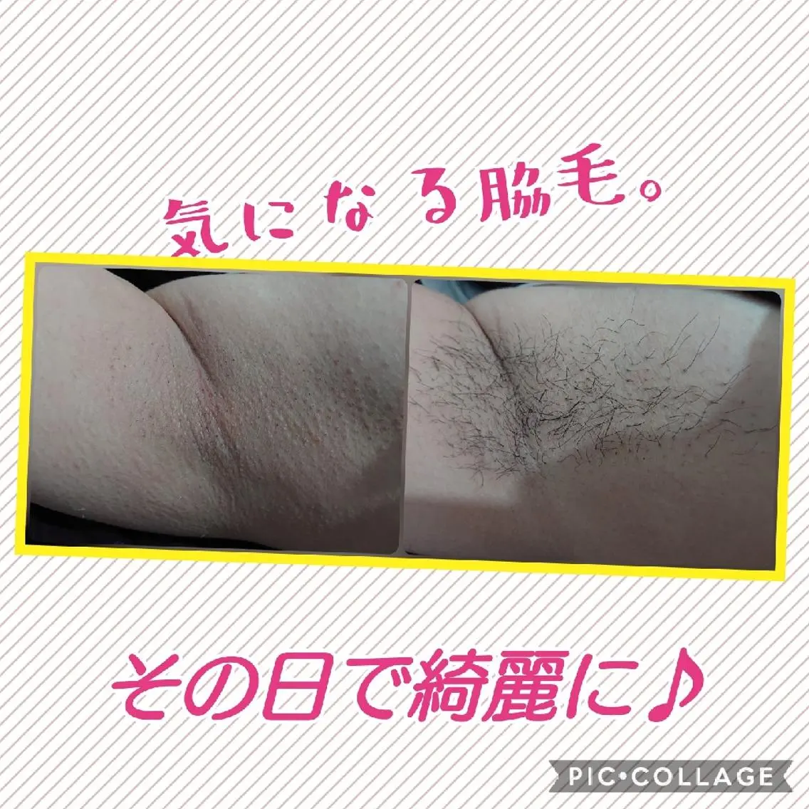 脱毛 リラクゼーション ふわりのエステ・リラクイメージ