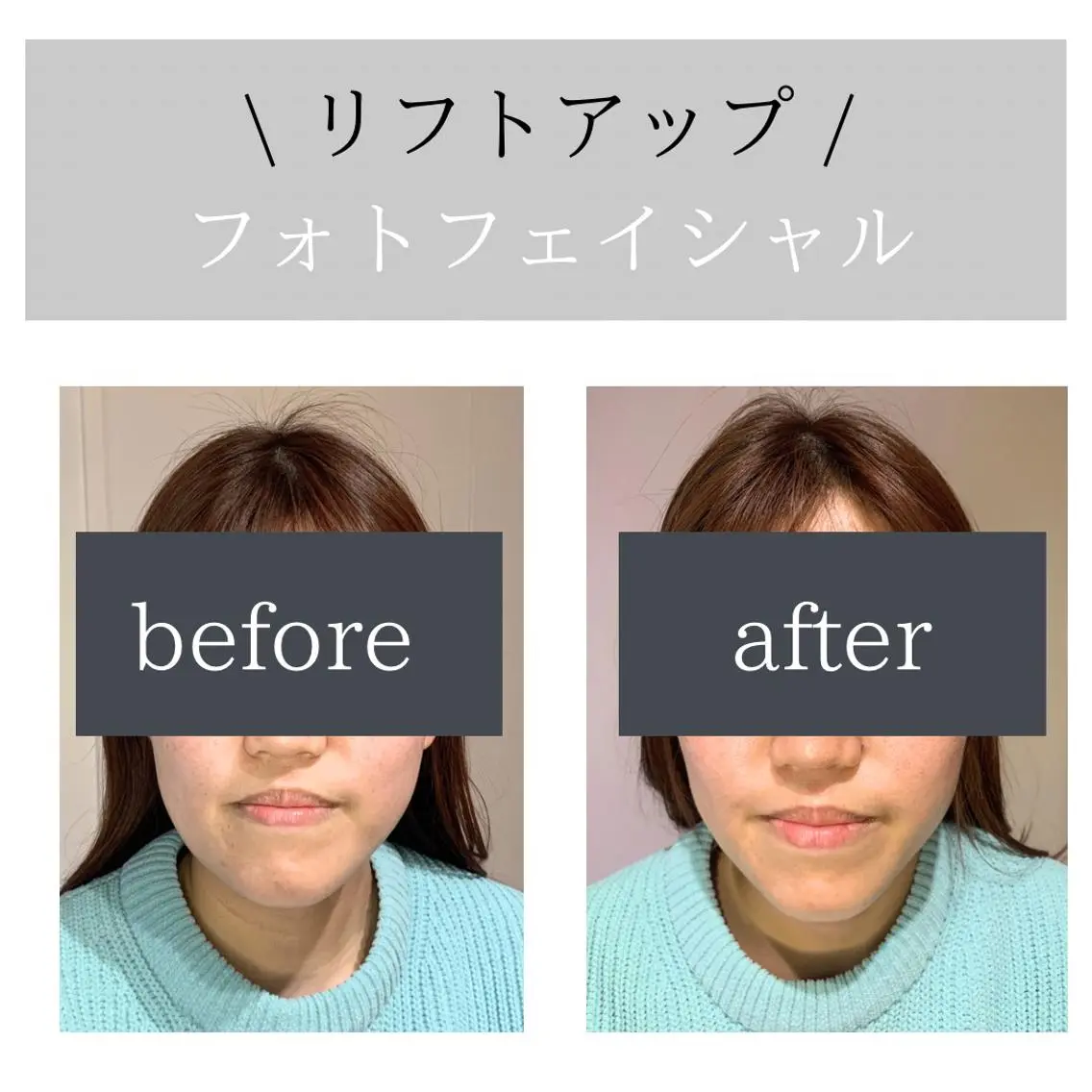脱毛サロン Lokahiのエステ・リラクイメージ