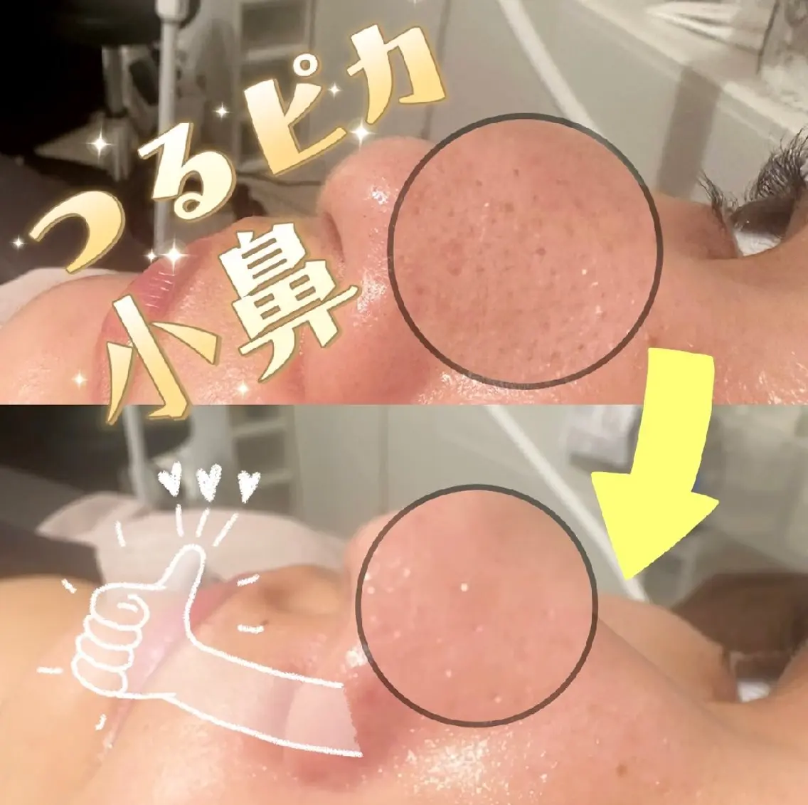 小鼻クレンジング ☆他のメニューとセットでされる方は¥1,100☆の写真