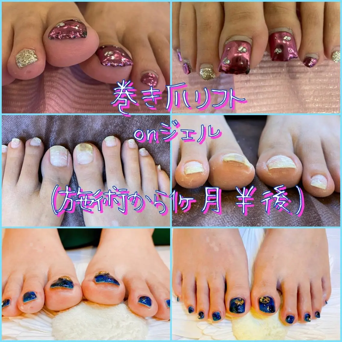 ネイル フットネイル ジェルネイル 持ち込み 夏ネイル ♢ME2ROOM♢ #巻き爪#リラクのネイルデザイン