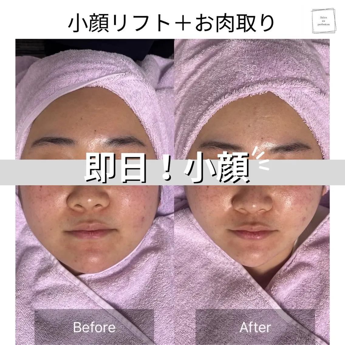 エステ salon de perfectionのエステ・リラクイメージ