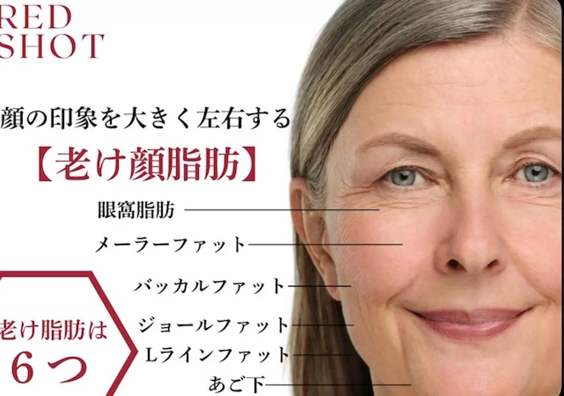 【目元の疲労感に】REDショットで目の下のクマ・たるみ・脂肪に徹底アプローチの写真