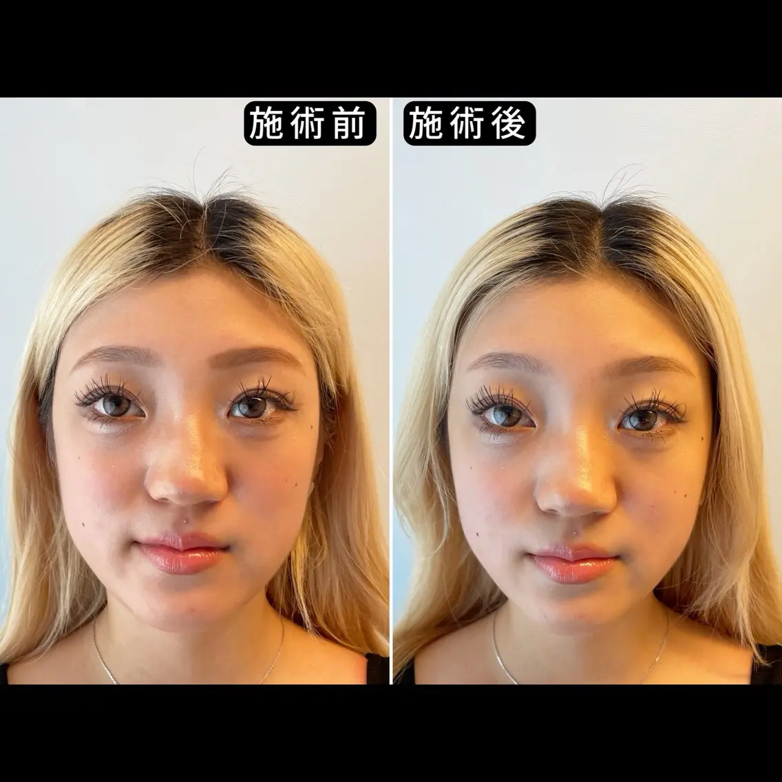 エステ リラク 渋谷 小顔美容鍼 専門サロン YZのその他イメージ