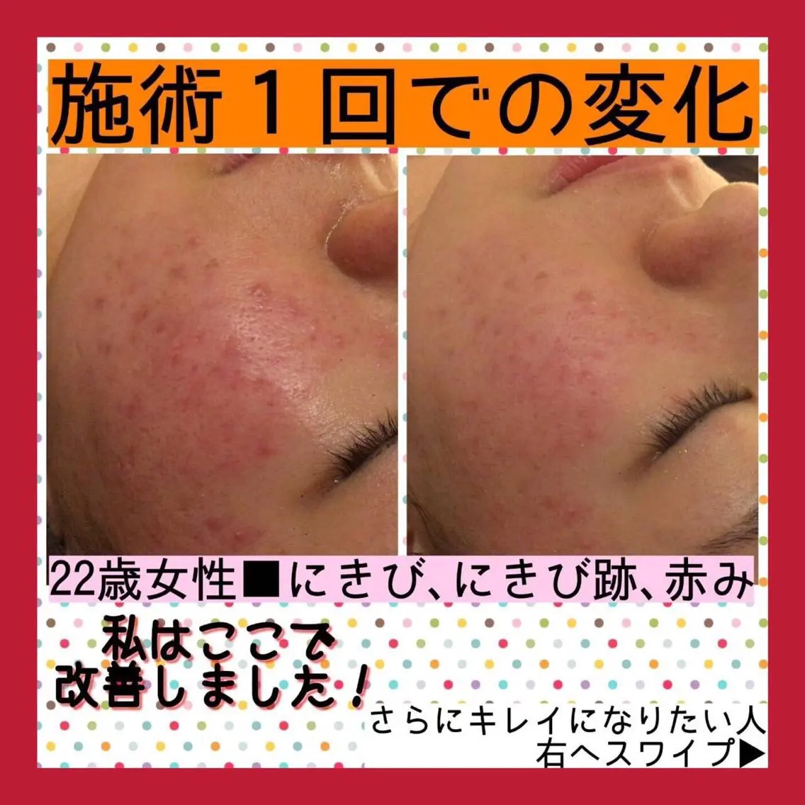 ミディアム カラー パーマ ヘアアレンジ メンズ キッズ ネイル マツエク・マツパ ニキビ・肌質改善専門 ♡人生が変わるサロンのエステ・リラクイメージ