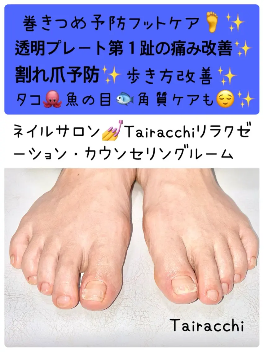 ネイル フットネイル Tairacchi タイラッチのエステ・リラクイメージ