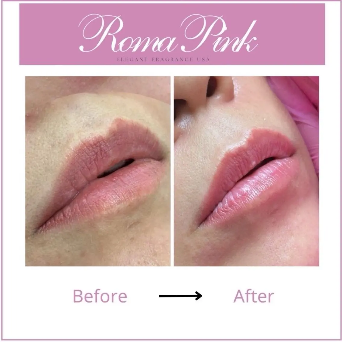 エステ CITRAtotal beautyのネイルデザイン