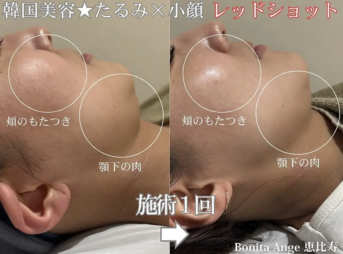 エステ 《モニター募集専用》 恵比寿肌質改善サロンのエステ・リラクイメージ