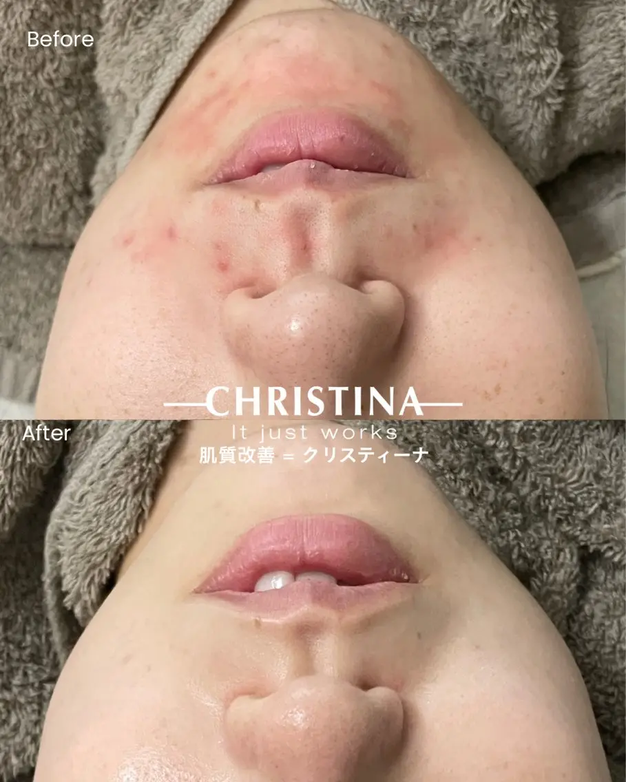 エステ SALON el 歯と肌の専門店のエステ・リラクイメージ