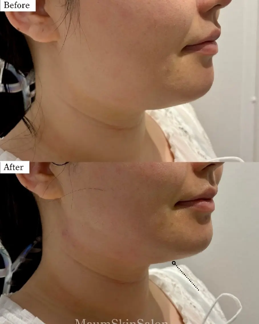 エステ Maum SkinSalonのエステ・リラクイメージ