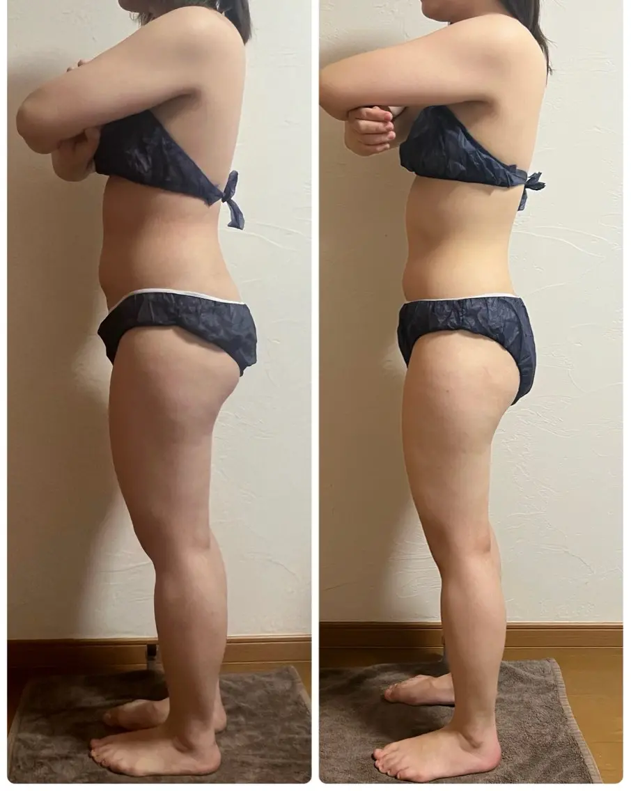 【新規】【全身痩せ】1回で変化実感✨全身90分しっかり痩身の写真