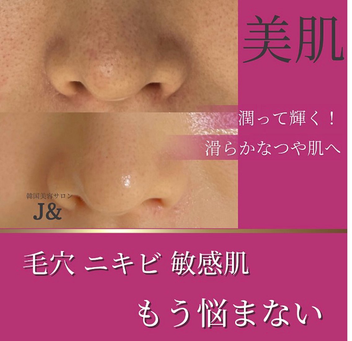 🫧美肌&体質改善 🌿mitekiのエステ・リラクイメージ