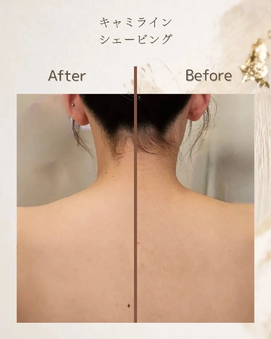 【顔/背中】顔&背中上段シェービングの写真