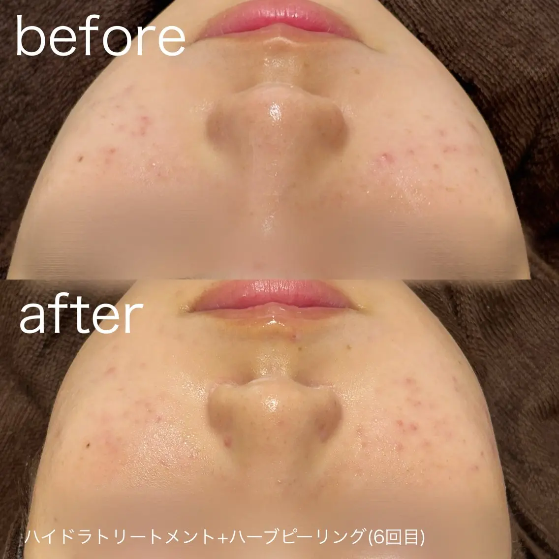 脱毛 lulularico Yuのネイルデザイン