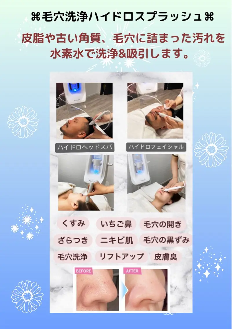 初回お試し価格　　　　　　　　　　　　　　　　　　　フェイス毛穴洗浄（パック付）ハイドロスプラッシュ✨の写真