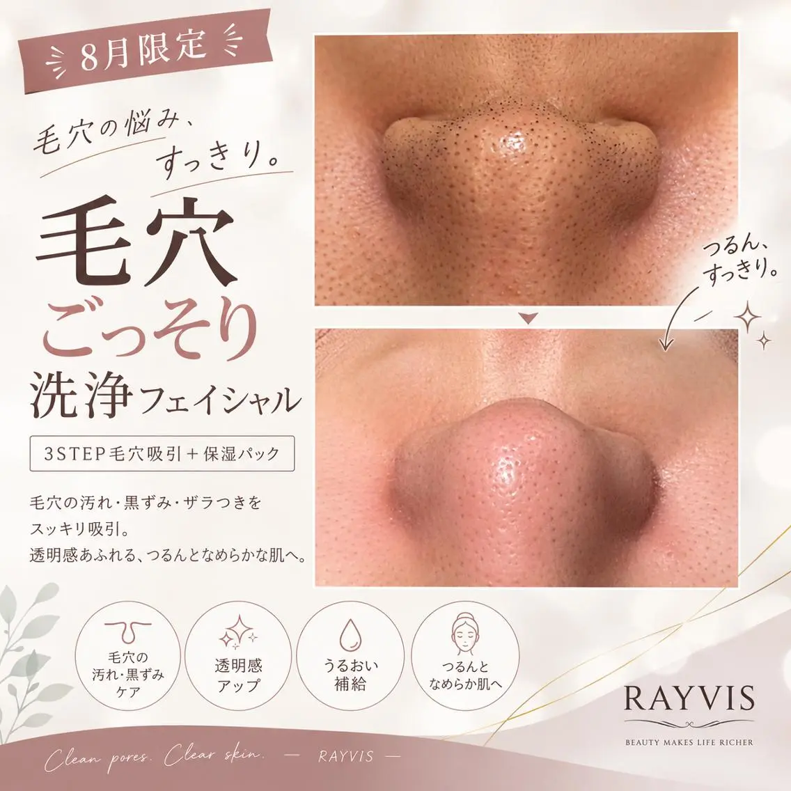 《8月限定🌻》毛穴ごっそり吸引洗浄で大掃除🧹💦毛穴汚れをリセットするならこちら♪の写真