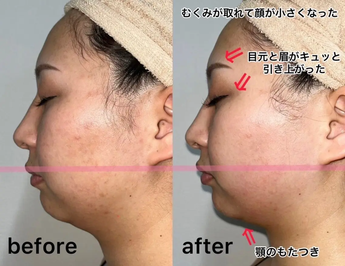 キッズ メンズ 脱毛*エステ*リラク 猫の手【丸田和可子】のエステ・リラクイメージ