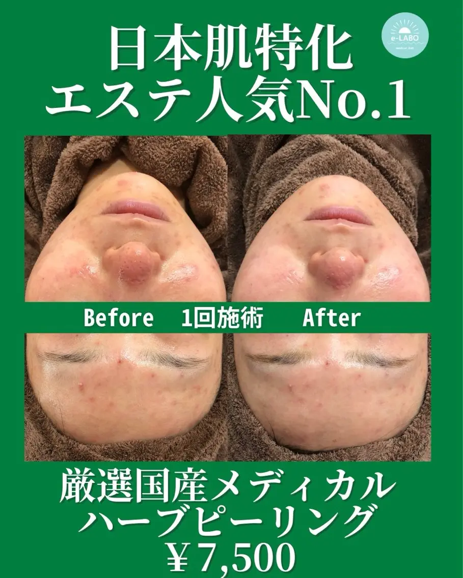 e-LABO 池袋のエステ・リラクイメージ