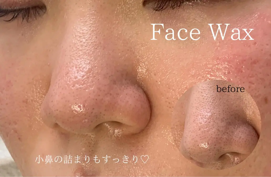 メンズ 脱毛 稲嶺 美華のエステ・リラクイメージ