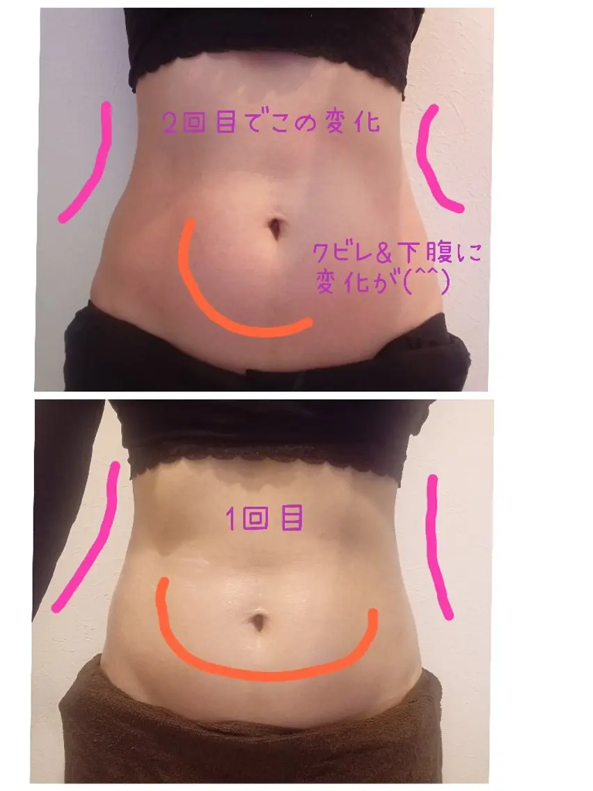 下半身夏までに引き締めコース60分の写真