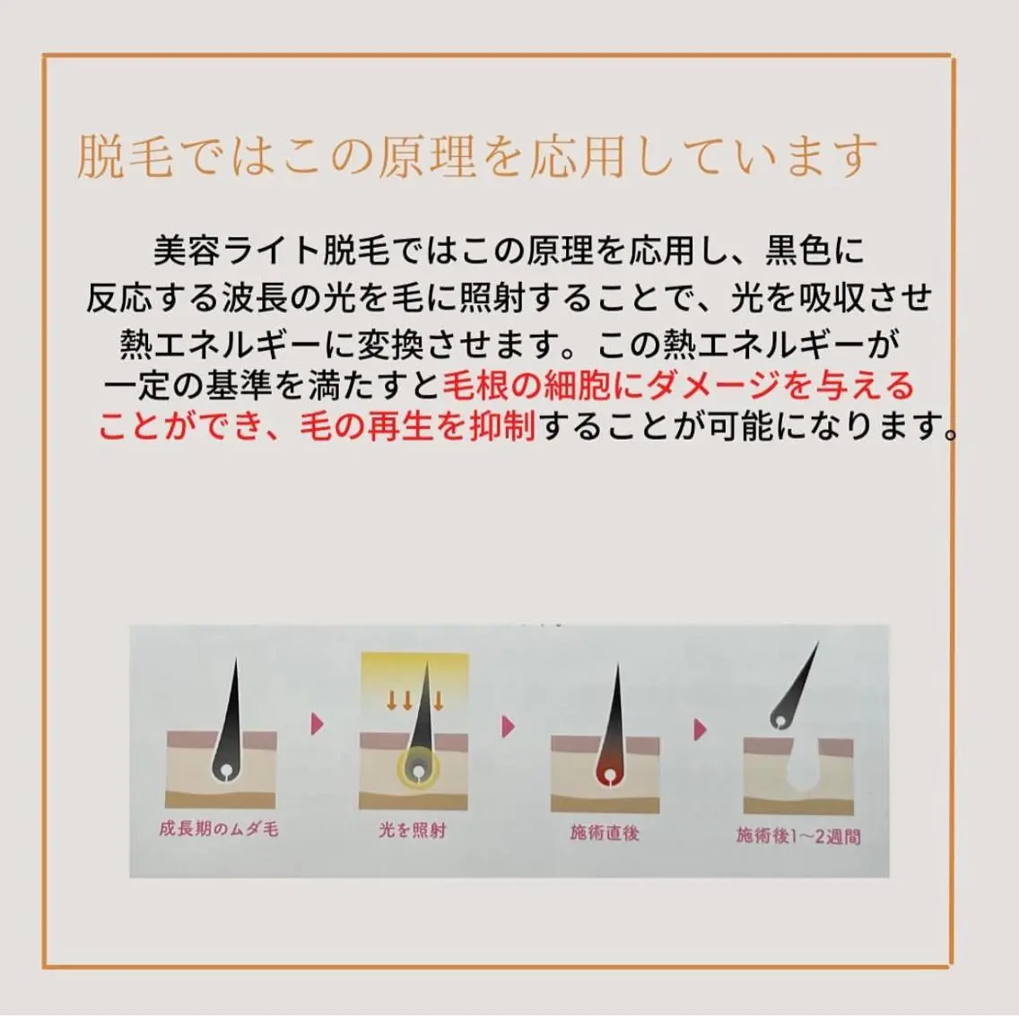 calimero 美肌脱毛サロンの眉毛・アイブロウイメージ