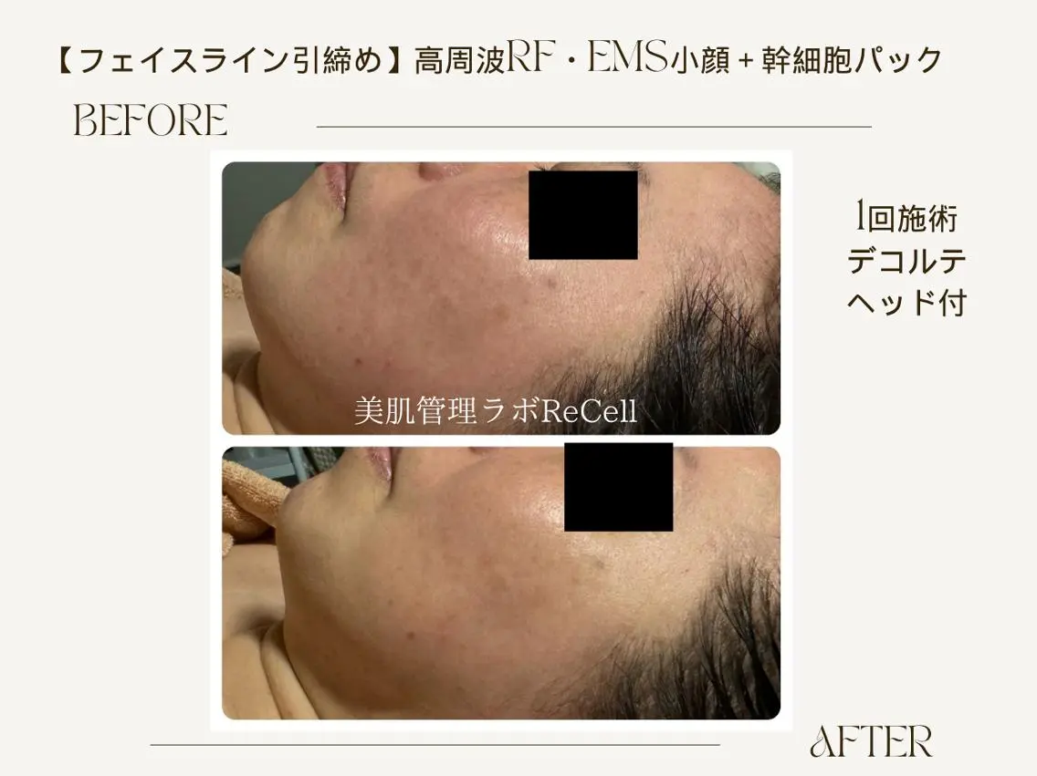 エステ ReCell 肌管理のエステ・リラクイメージ