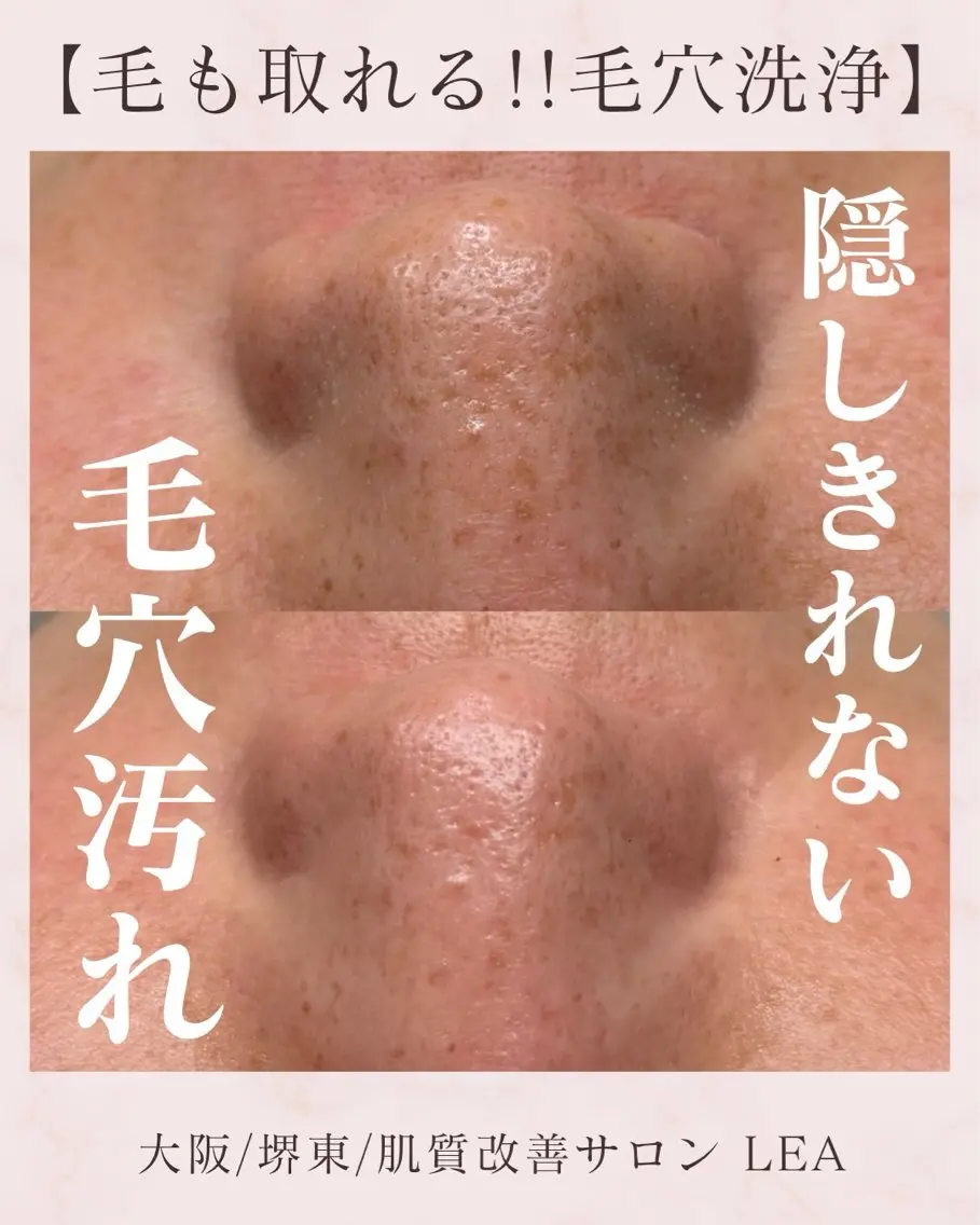 エステ Lea堺東　　眉毛| 毛穴洗浄|顔WAXのその他イメージ