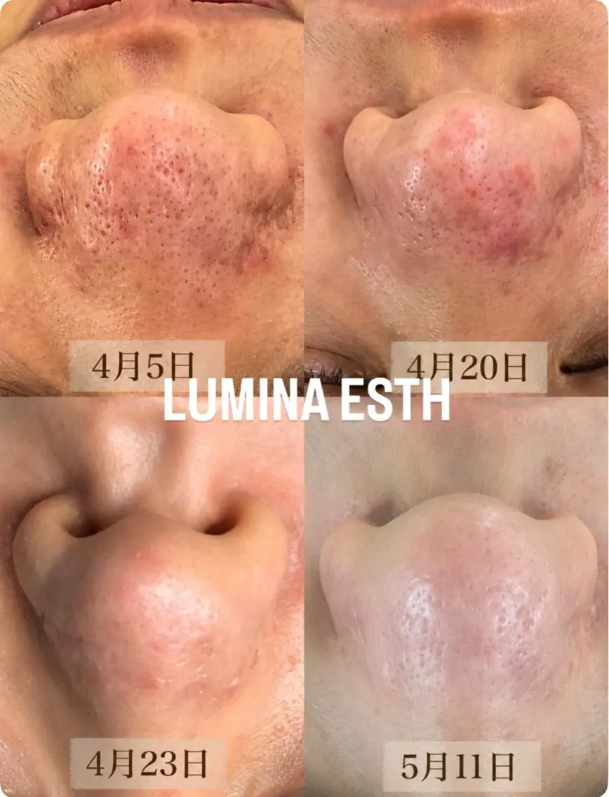 LUMINA ESTHのエステ・リラクイメージ
