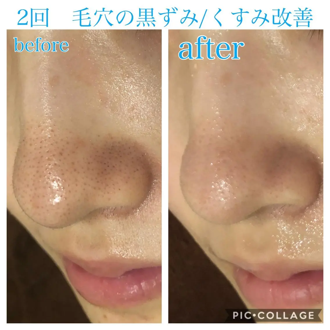 ロング カラー パーマ ヘアアレンジ メンズ ネイル マツエク・マツパ エステ リラク EnsorClair 代表 野口真央のエステ・リラクイメージ