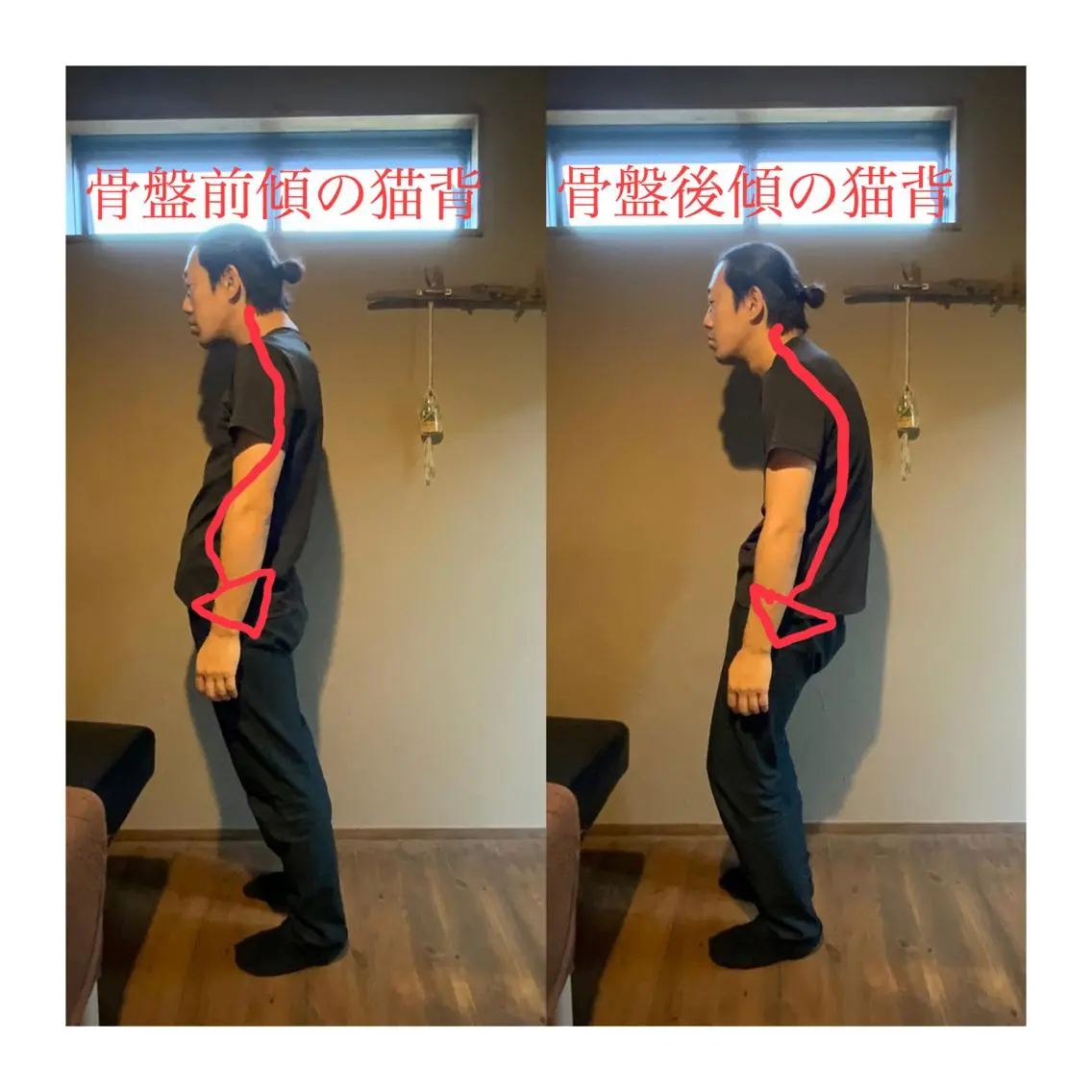 骨盤矯正の写真