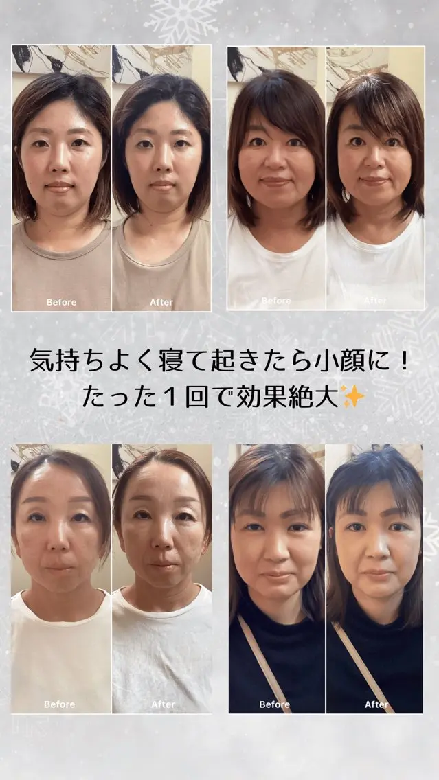 小顔ヘッドスパサロン アコテのエステ・リラクイメージ