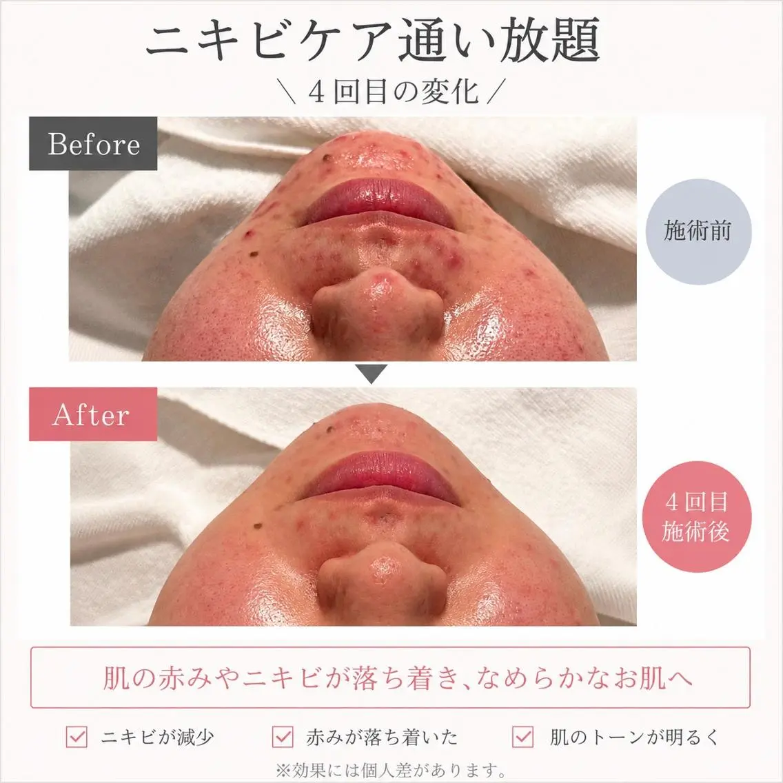 【メンズ脱毛・美肌】 SARA 恵比寿店のエステ・リラクイメージ