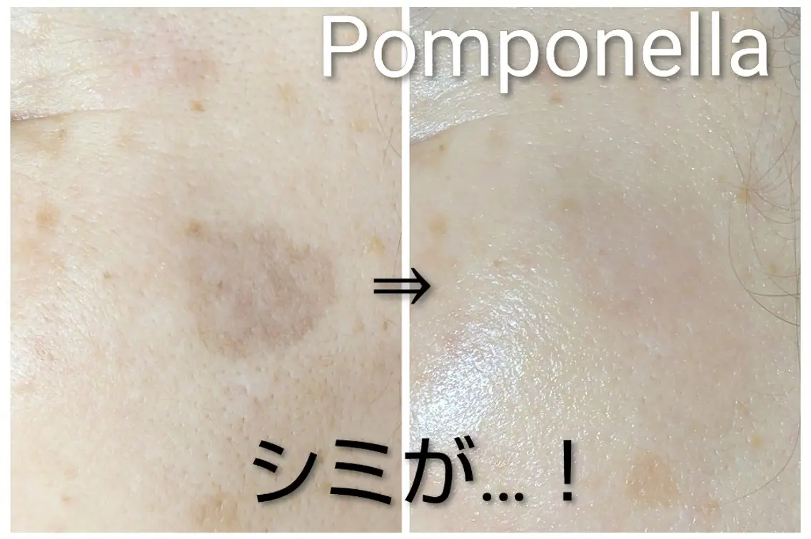 【平日限定】レチノール＋ハーブの最強コンビ⭐️ ➕️ビタミンC誘導体でぷるもち白玉肌へ✨【うるツヤ白玉ケア 約75分】の写真