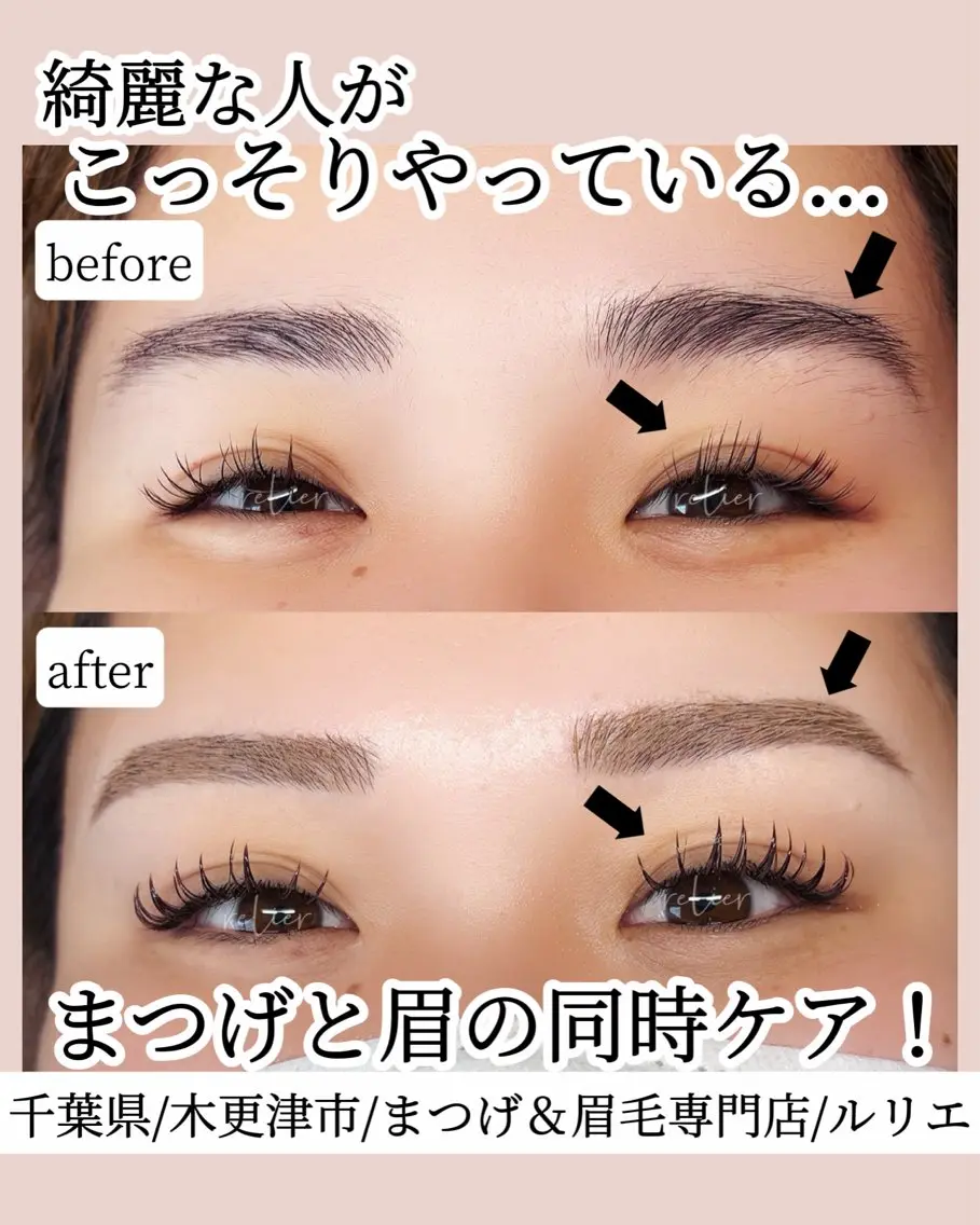 美眉ワックス脱毛の写真