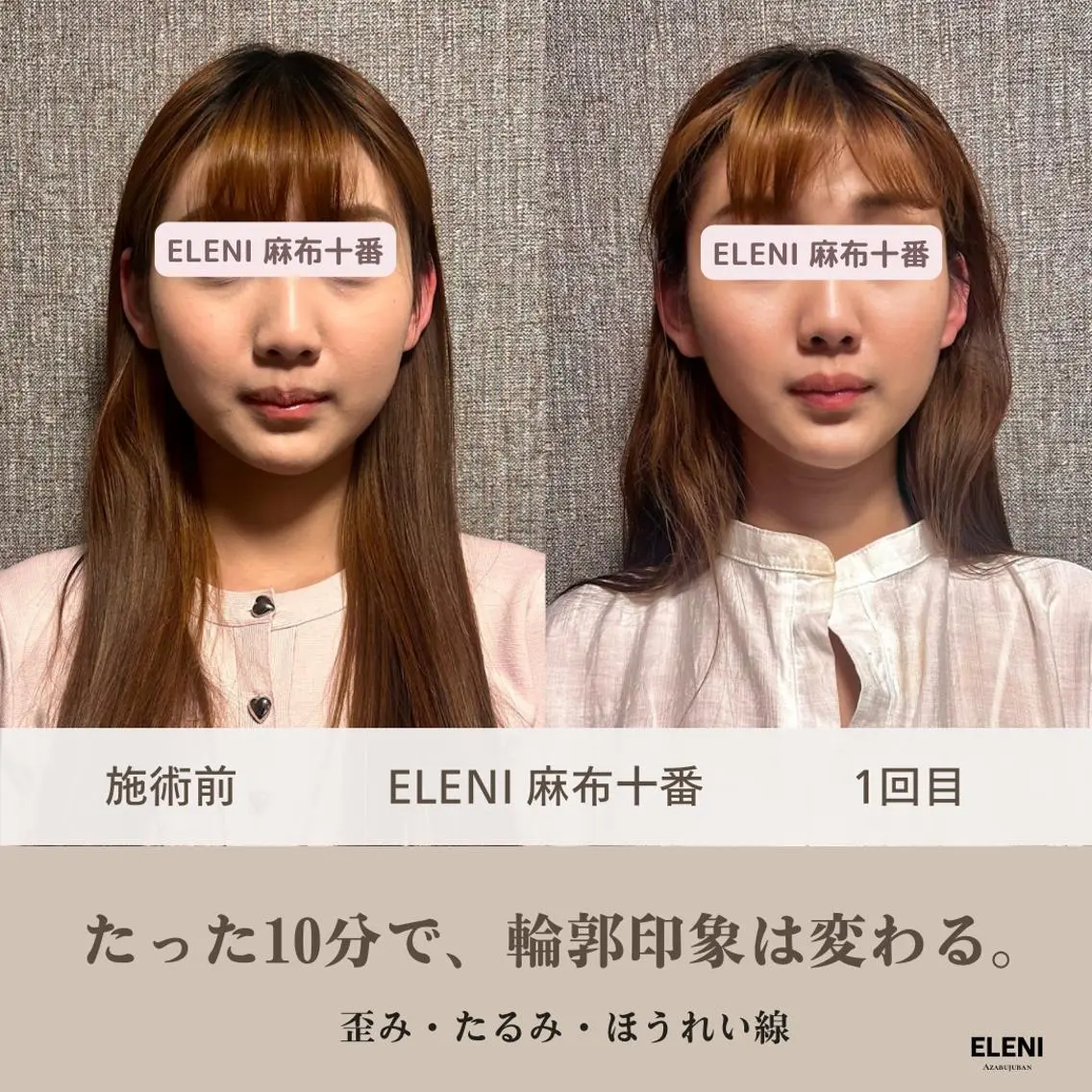 麻布十番小顔コルギ 姿勢矯正リアン💗のエステ・リラクイメージ