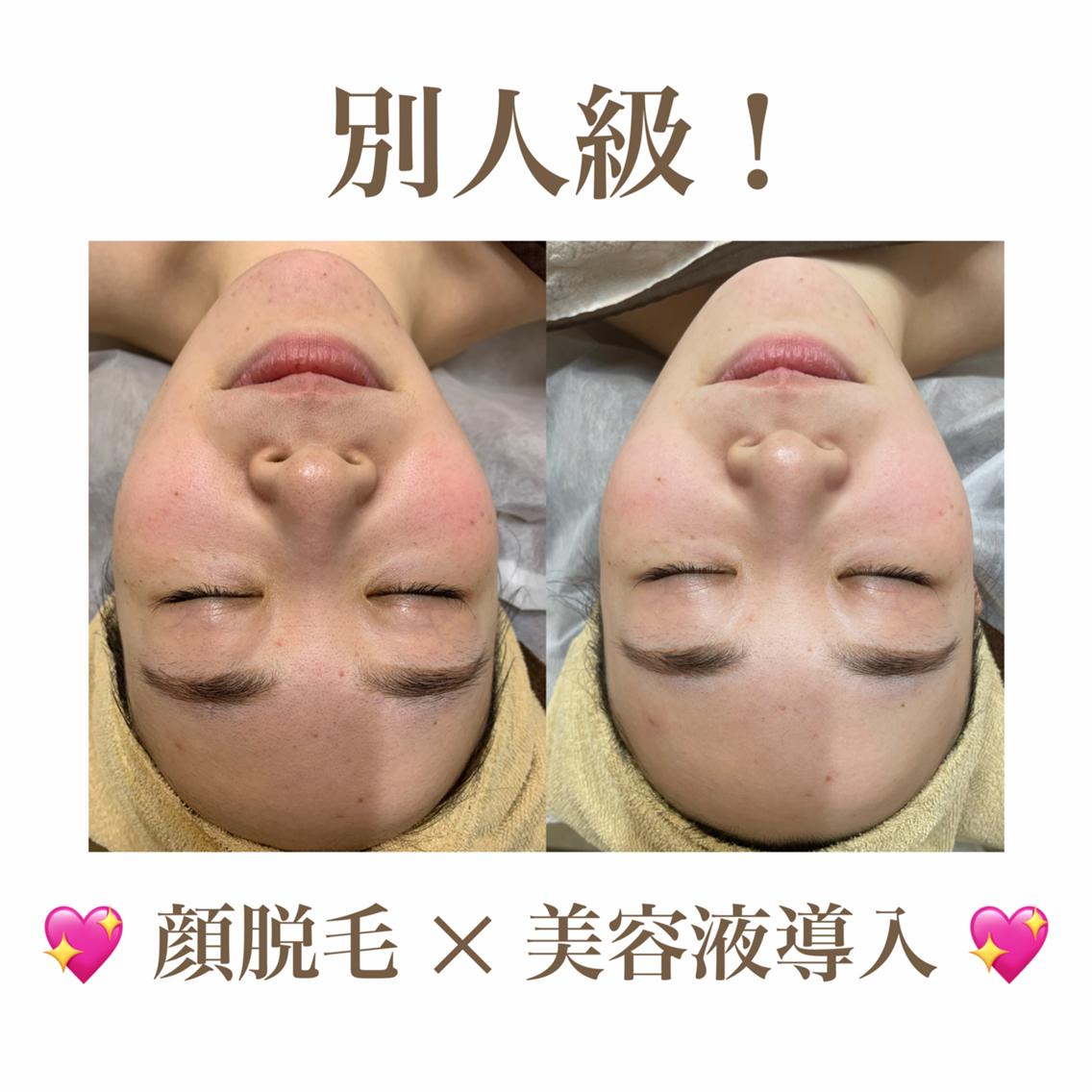 エステ 🫧美肌サロン🫧 レイビスひかる🧡のエステ・リラクイメージ