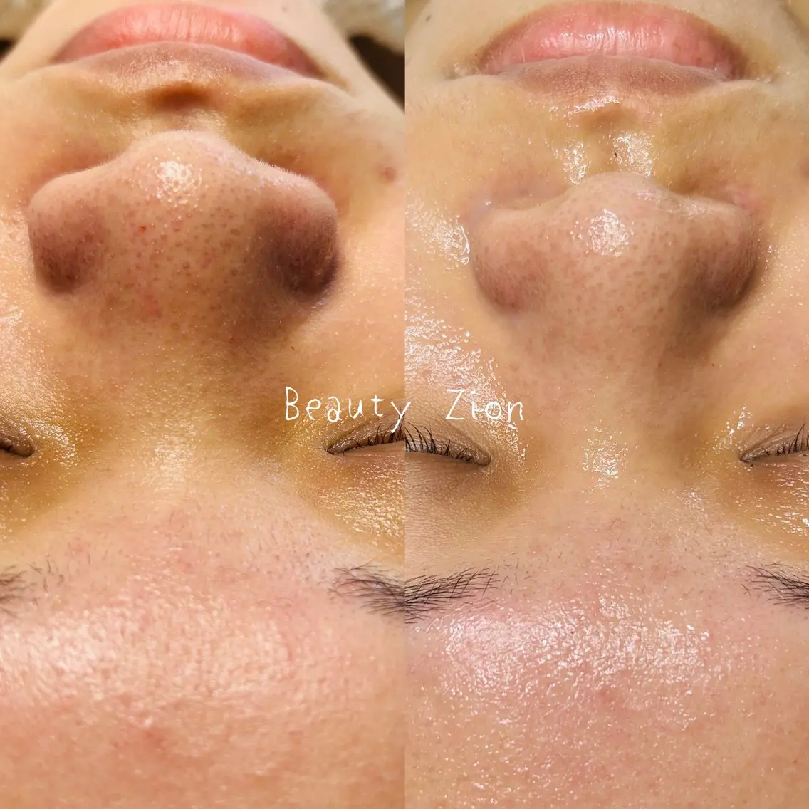 Beauty Zionのエステ・リラクイメージ