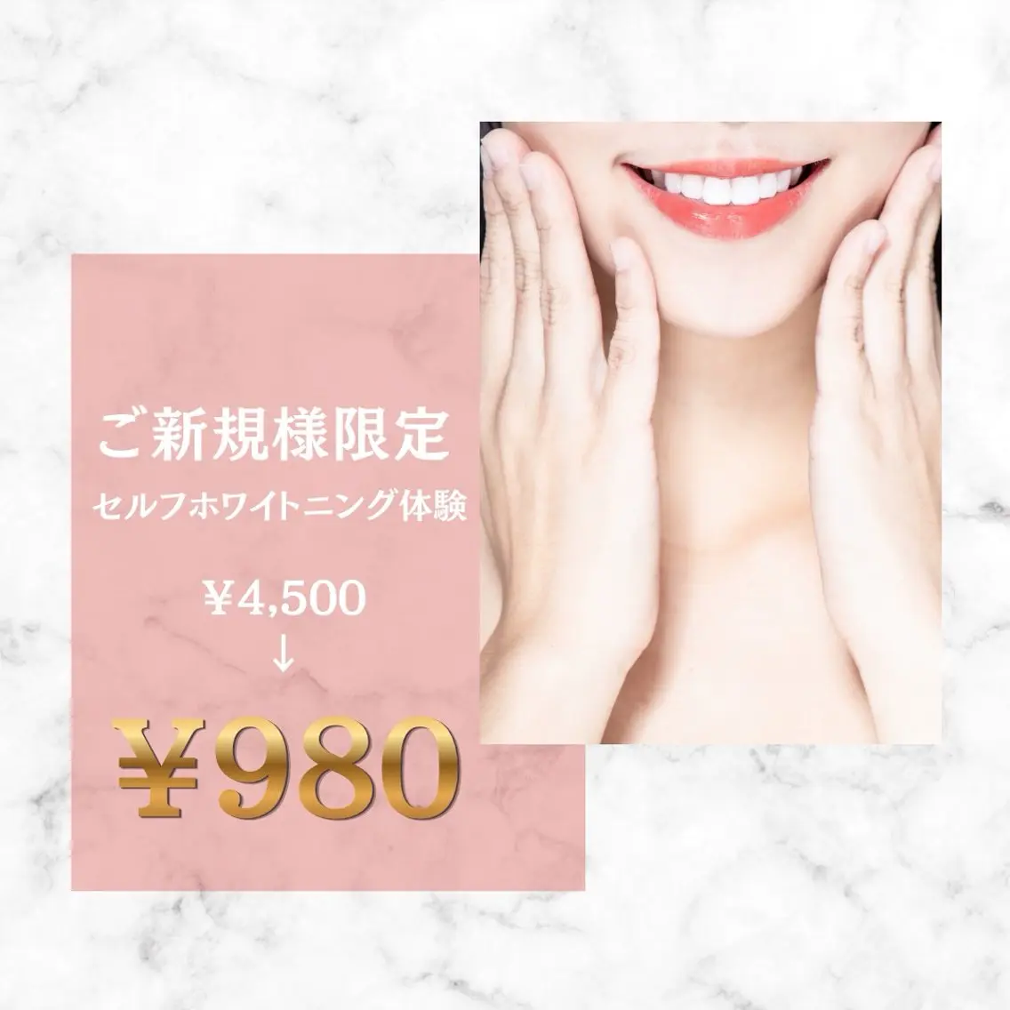 【ご新規様限定】清潔感UP⤴️SNS・写真が楽しくなるセルフホワイトニング体験🦷✨4500円⇒980円❕の写真
